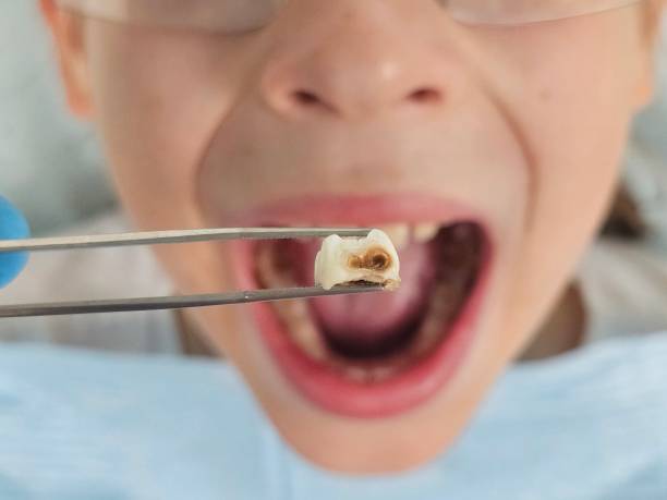 Best Weekend Emergency Dentist in Windber, PA